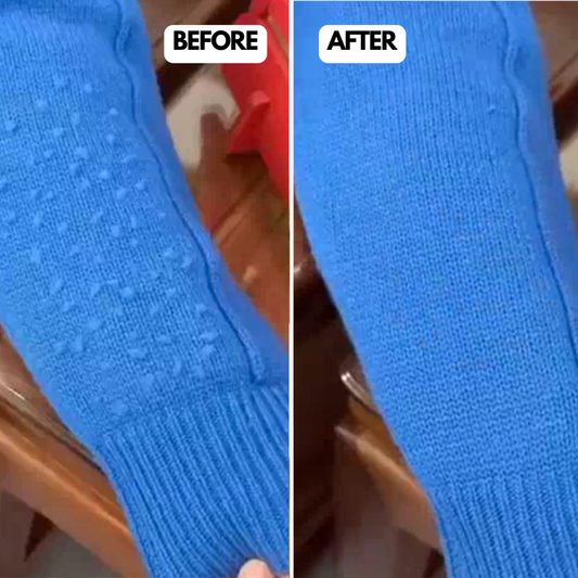 Remover Pro™ 2.0 – The Ultimate Fabric Saver